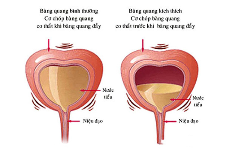 bang-quang-tang-hoat.jpg